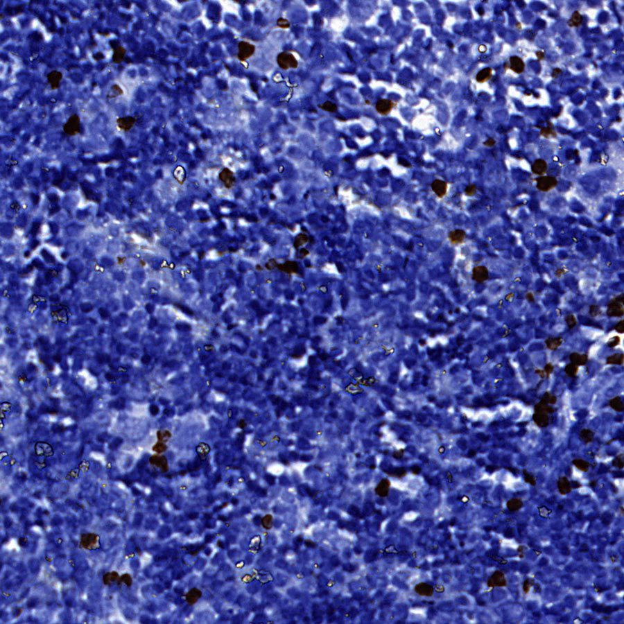 MMP-8 Recombinant Rabbit mAb (S-5674)