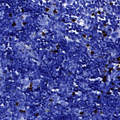 MMP-8 Recombinant Rabbit mAb (S-5674)