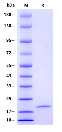 Human CDK8 Protein, His tag