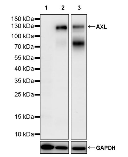 AXL Recombinant Rabbit mAb (S-2199-80)