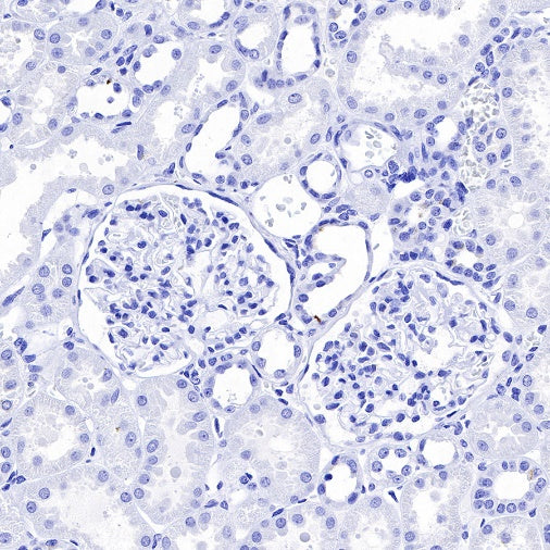 S-RMab® CGA/HCG-α Recombinant Rabbit mAb (SDT-643-61)