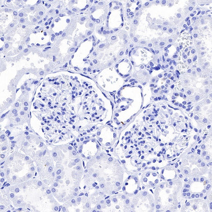 S-RMab® CGA/HCG-α Recombinant Rabbit mAb (SDT-643-61)
