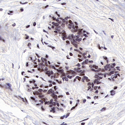 BRCA1 Recombinant Mouse mAb (S-4707)