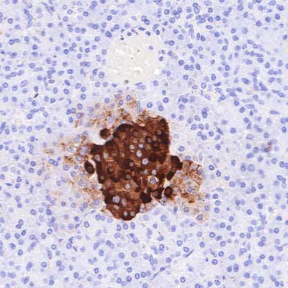S-RMab® Chromogranin A Recombinant Rabbit mAb (SDT-074-57)