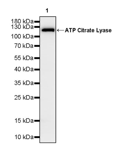 ATP Citrate Lyase Recombinant Rabbit mAb (S-5036)