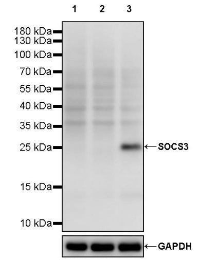 SOCS3 Recombinant Rabbit mAb (S-2238-34)
