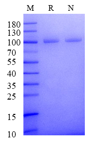 Non-Biotinylated ANDR(LBD) His&Avi Tag Protein, Human