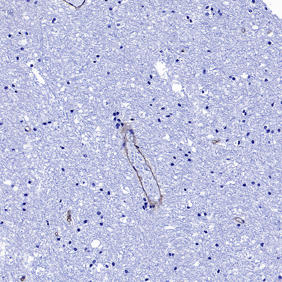 CD151 Recombinant Rabbit mAb (S-3235-104)