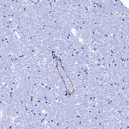 CD151 Recombinant Rabbit mAb (S-3235-104)