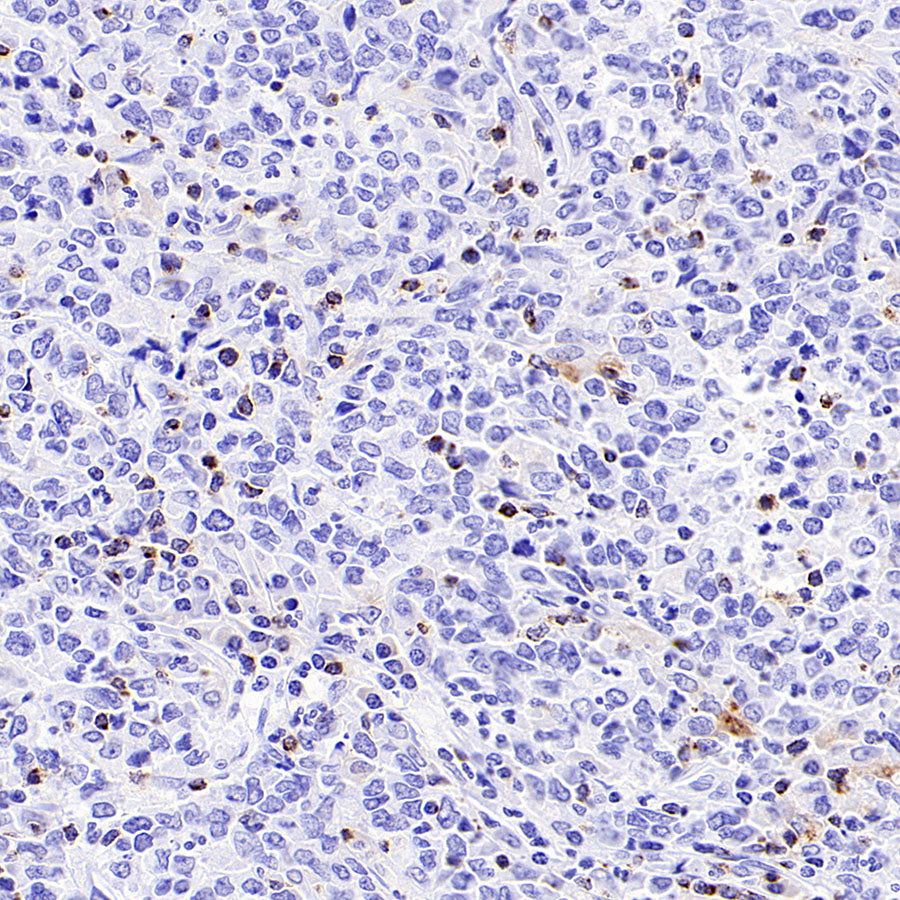 CCL18 Recombinant Rabbit mAb (S-2788-25)