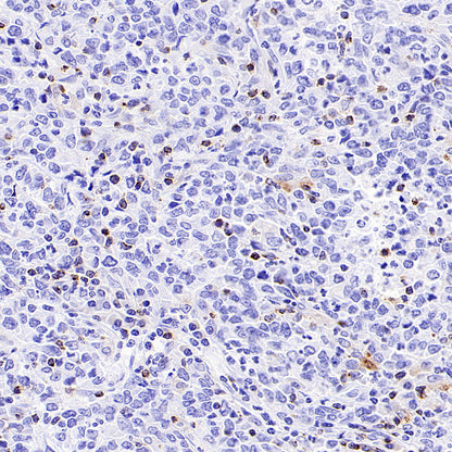 CCL18 Recombinant Rabbit mAb (S-2788-25)