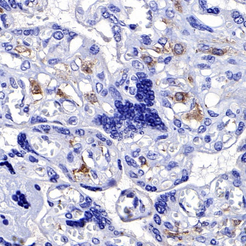 CSF-1R Recombinant Rabbit mAb (S-467-26)