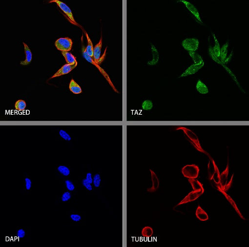 TAZ Recombinant Rabbit mAb (S-2812-102)