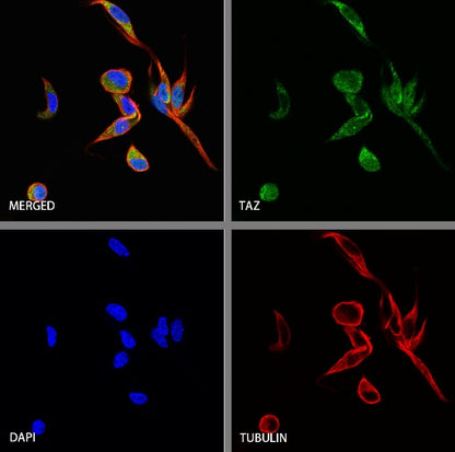 TAZ Recombinant Rabbit mAb (S-2812-102)