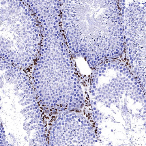 Histone H3 (di methyl K56) Recombinant Rabbit mAb (S-R427)