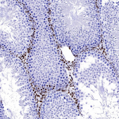 Histone H3 (di methyl K56) Recombinant Rabbit mAb (S-R427)