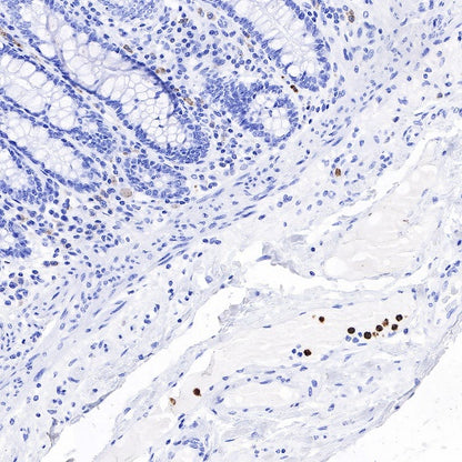 CD66b Recombinant Rabbit mAb (S-766-55)