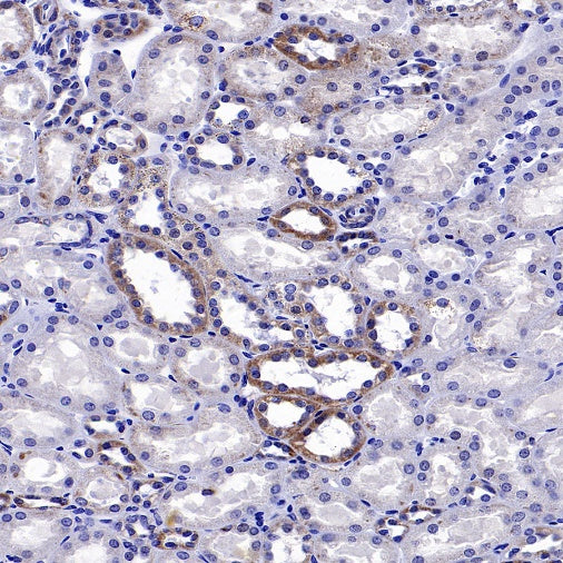SOD2/MnSOD (acetyl K68) Rabbit Polyclonal Antibody