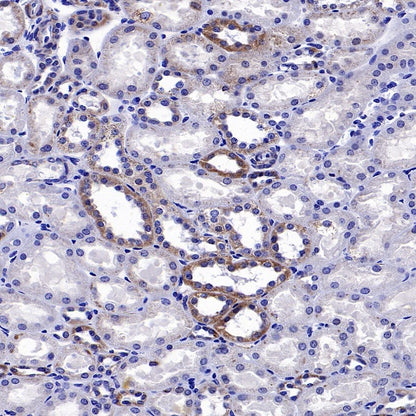 SOD2/MnSOD (acetyl K68) Rabbit Polyclonal Antibody
