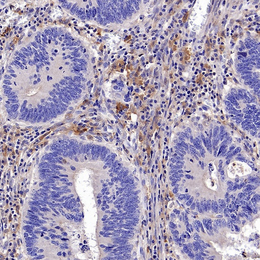 TLR2 Recombinant Rabbit mAb (S-2585-57)