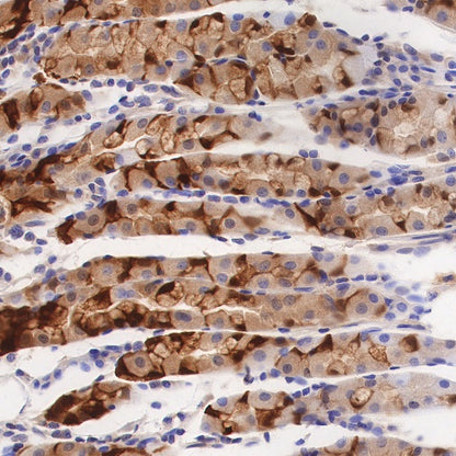 ALDH3A1 Recombinant Rabbit mAb (S-R220)