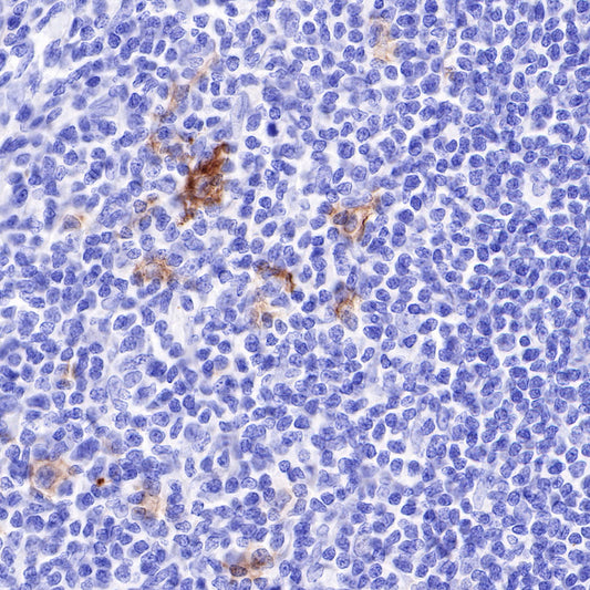 CD30 Recombinant Rabbit mAb (SDT-216-2)
