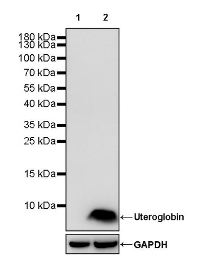 Uteroglobin Recombinant Rabbit mAb (SDT-2736-46)