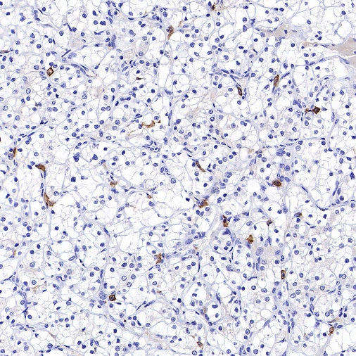 FCER1A/FcεRIα Recombinant Rabbit mAb (S-1697-174)