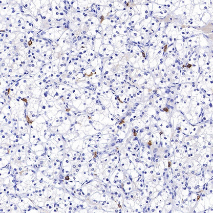 FCER1A/FcεRIα Recombinant Rabbit mAb (S-1697-174)