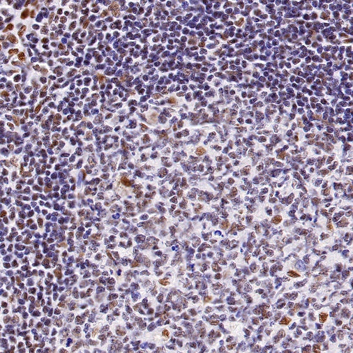 Cyclin K Recombinant Rabbit mAb (S-1586-18)