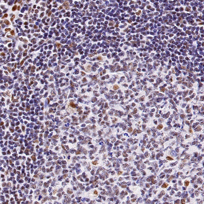 Cyclin K Recombinant Rabbit mAb (S-1586-18)