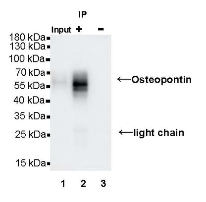 Osteopontin Recombinant Rabbit mAb (S-1005-50)