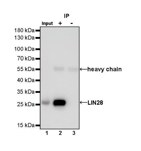 LIN28 Recombinant Rabbit mAb (S-795-8)