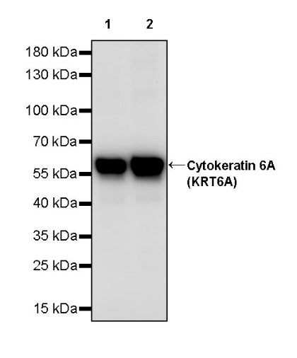Cytokeratin 6A (KRT6A) Recombinant Mouse mAb (SDT-3380)