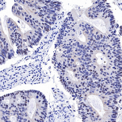 MSH2 Recombinant Rabbit mAb (SDT-037-20)