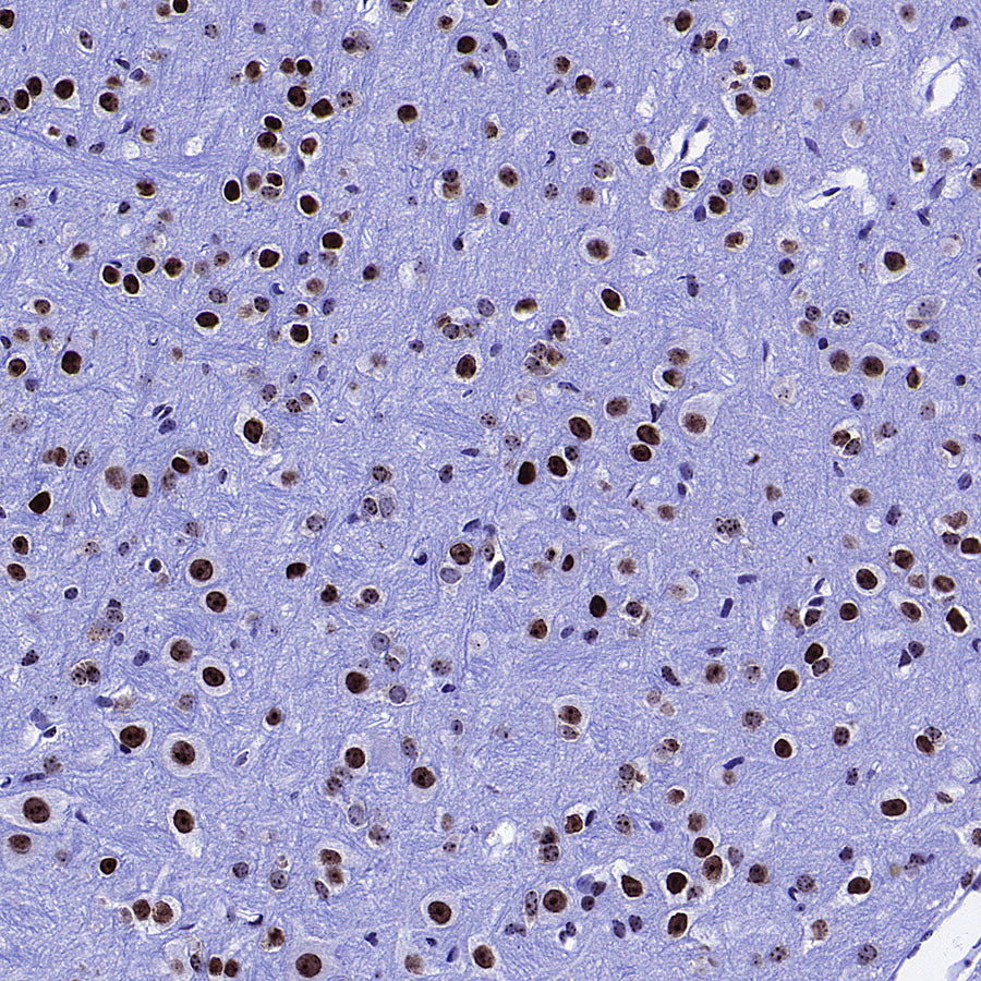 KDM2A Recombinant Rabbit mAb (S-3943-25)
