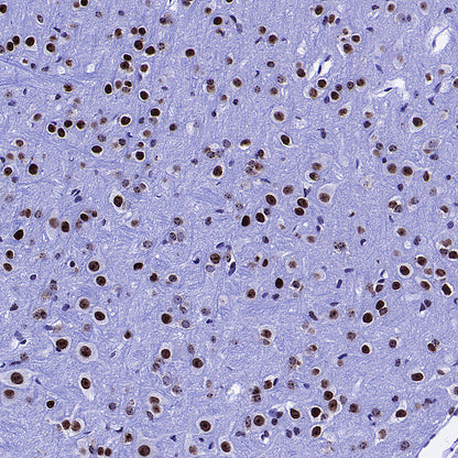 KDM2A Recombinant Rabbit mAb (S-3943-25)