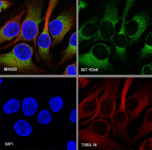 GRP94 Recombinant Rabbit mAb (S-R268)