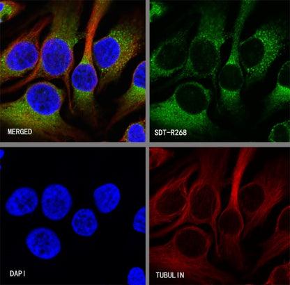 GRP94 Recombinant Rabbit mAb (S-R268)