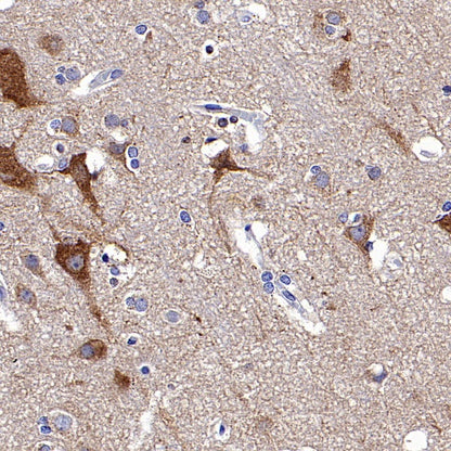 FUNDC1 Rabbit Polyclonal Antibody
