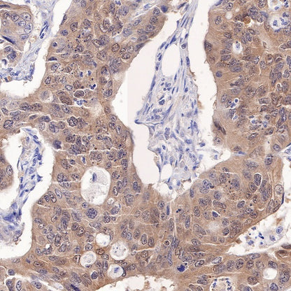MTAP Recombinant Rabbit mAb (S-813-23)