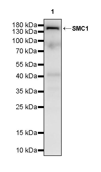 SMC1 Recombinant Rabbit mAb (S-4147-54)