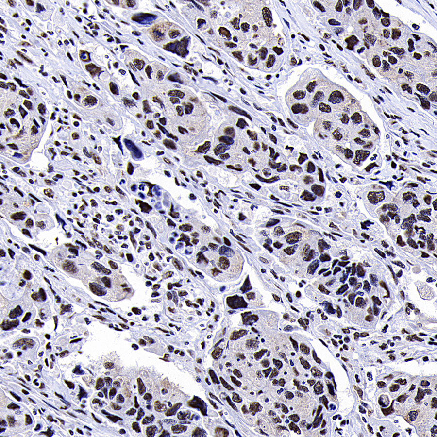 EIF4A3 Mouse mAb