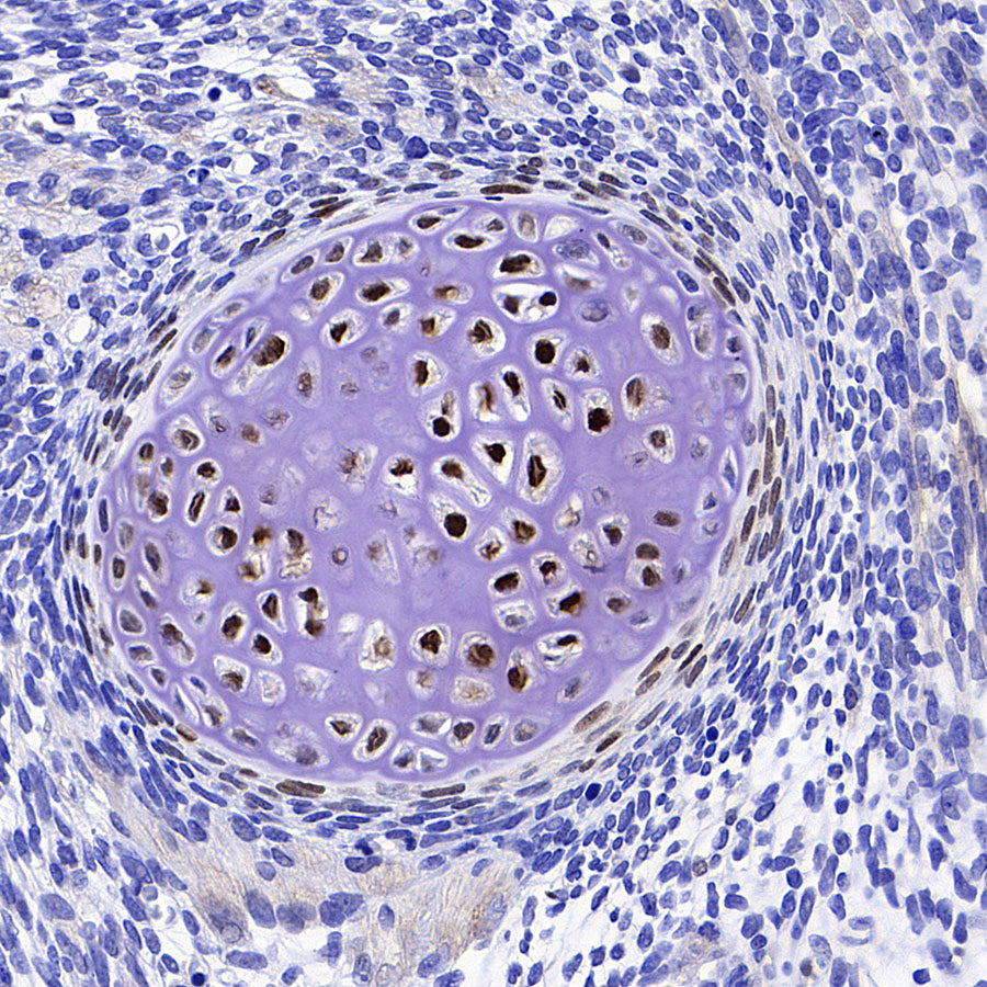 Sp7/Osterix Recombinant Rabbit mAb (S-4225-14)