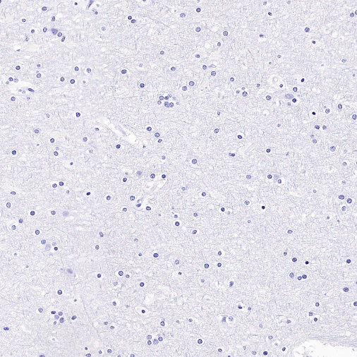 Sialoadhesin/CD169 Recombinant Rabbit mAb (SDT-3228-8)