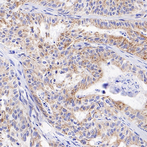 DLST Rabbit Polyclonal Antibody