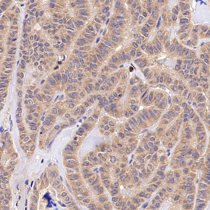 TYK2 Recombinant Rabbit mAb (S-2740-165)
