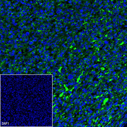 CD19 Recombinant Rabbit mAb (SDT-164-41)