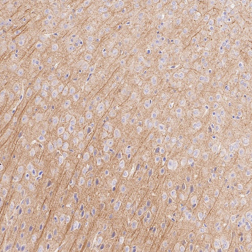 MAP2 Recombinant Rabbit mAb (S-3110-72)