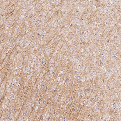 MAP2 Recombinant Rabbit mAb (S-3110-72)